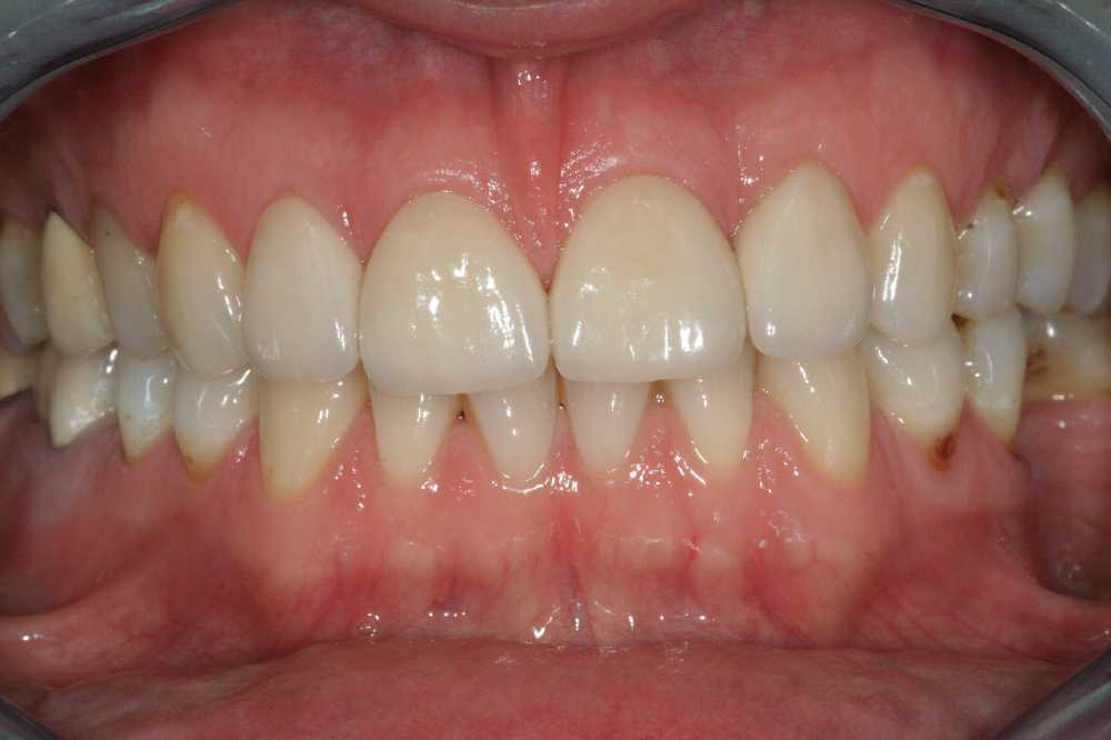 Afbeelding van Facings